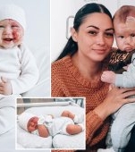 O mamă a decis să opereze cu laser semnul din naștere facial al copilului ei și internauții o consideră un monstru
