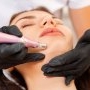 Sylfirm X: ce este și ce beneficii are cea mai nouă tehnologie de microneedling RF?