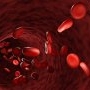 Anemia falciforma: cauze, simptome si tratament