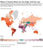 Procentajul de nasteri prin cezariana in toate tarile din lume