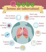 Semne că ai putea să ai tuberculoză