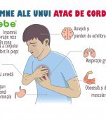 11 semne care indică un atac de cord