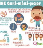 Gură-mână-picior: semne că al tău copil are această boală a copilăriei