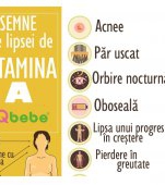 Semne că ai lipsă de vitamina A