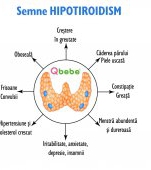 Semne că suferi de hipotiroidism