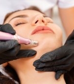 Sylfirm X: ce este și ce beneficii are cea mai nouă tehnologie de microneedling RF?