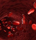 Anemia falciforma: cauze, simptome si tratament