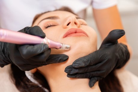 Sylfirm X: ce este și ce beneficii are cea mai nouă tehnologie de microneedling RF?