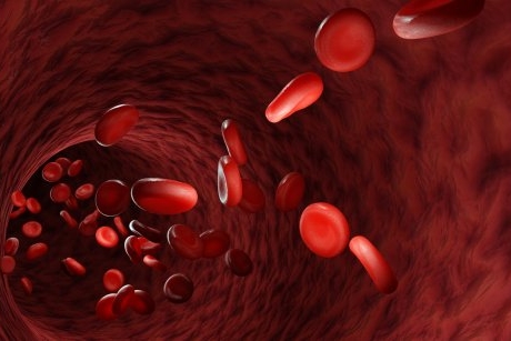 Anemia falciforma: cauze, simptome si tratament