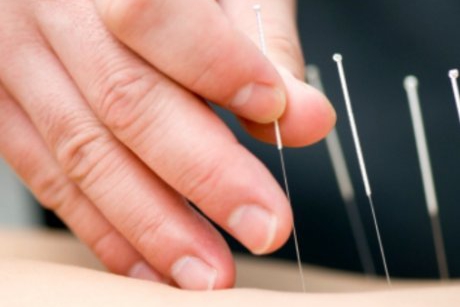 Sustinere pentru tratament prin acupunctura